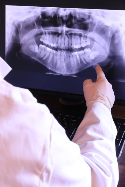 Best Broken or Chipped Tooth Repair in Southwood Acres, CT