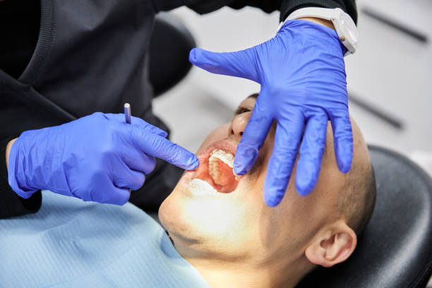 Best Emergency Treatment for Oral Infections in Southwood Acres, CT